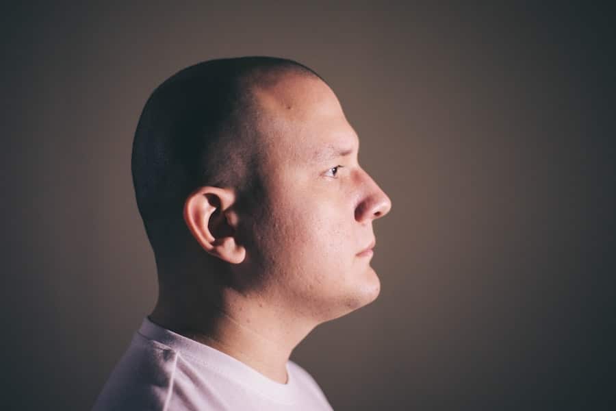 Photo head